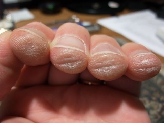 Cách giảm đau nhức ngón tay khi mới tập đàn Guitar